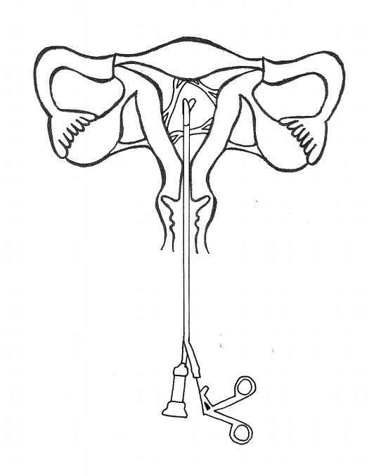 behandeling afbeelding